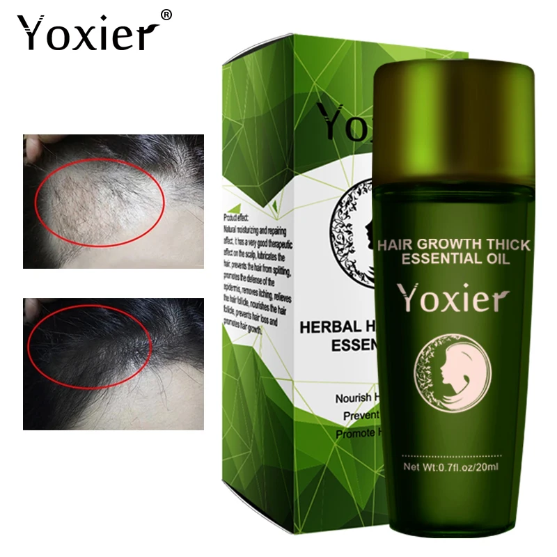 Yoxier Herbal Hair Growth Essential Oil Shampoo hair care styling Hair Loss Product Thick Fast Repair Growing Treatment Liquid