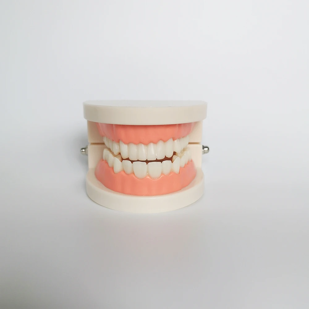 Neues Dentalmodell für Zahnimplantate, Restaurationsbrücken, Lehrmaterial für Medizinische Wissenschaft, Krankheiten, Zahnärzte und Zahnmedizinprodukte – Detail 7