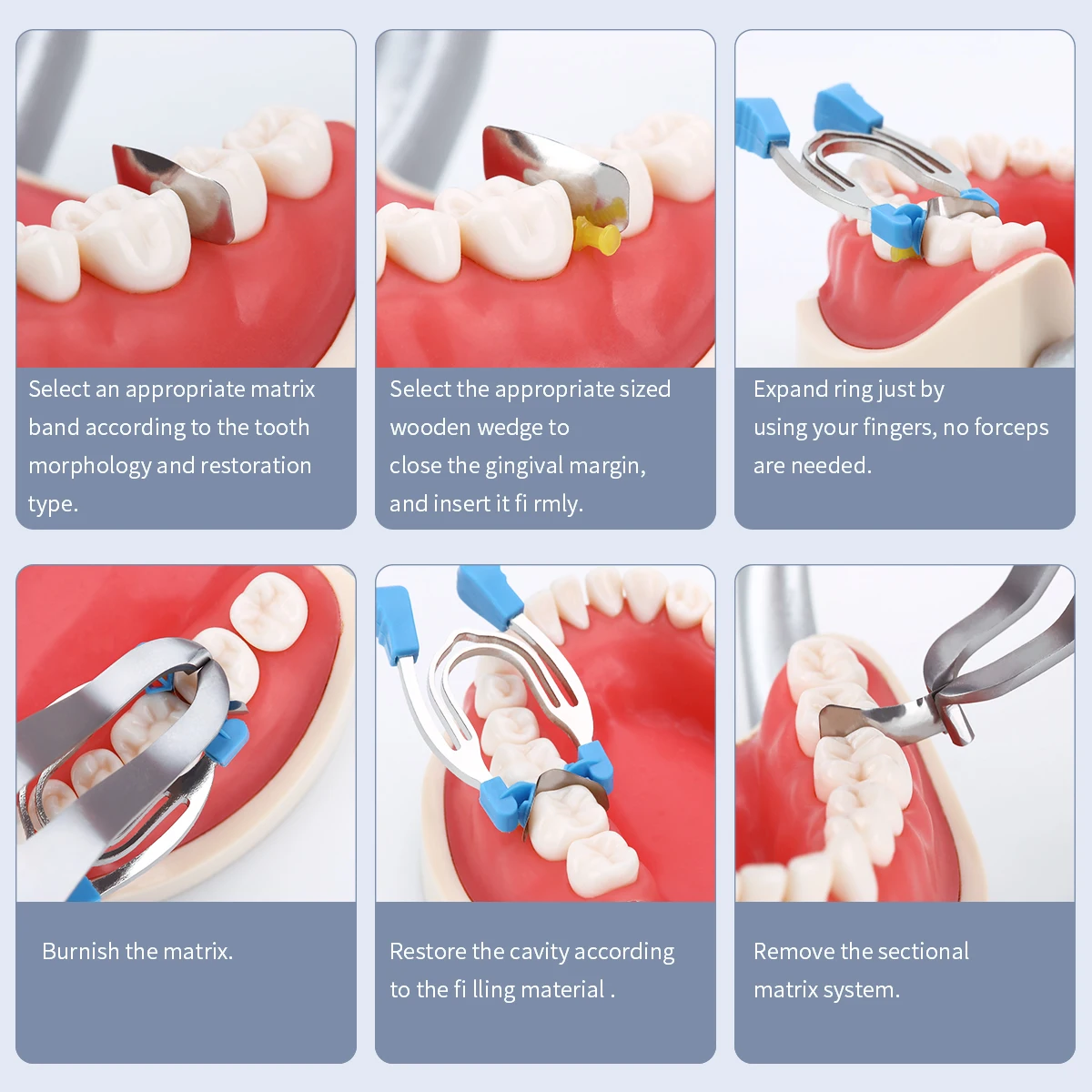 Azdent Dental Matrix Seccional, Metal Contorneado, Primavera Clip Anéis, Grampos Cunhas, Ferramentas Dentista
