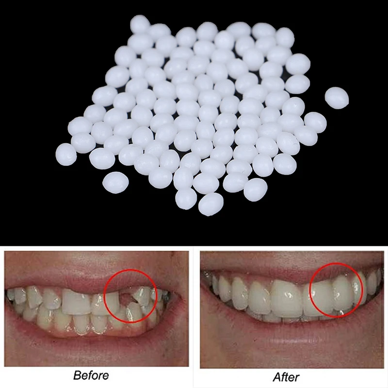 Temporary Tooth Repair Kit Teeth And Gaps FalseTeeth Solid Glue Denture Adhesive Teeth Whitening Tooth Beauty Tool 5/10/15/20g