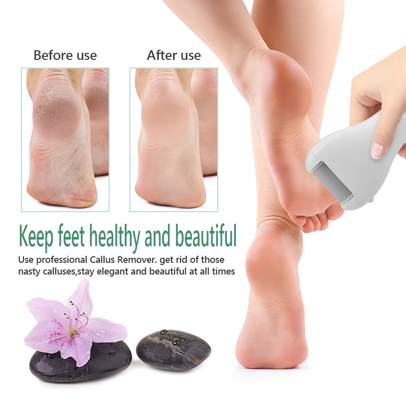 Substituição cabeças do rolo para pro pedicure pé ferramenta de cuidados com os pés removedor calo eletrônico pé arquivos rolos removedor da pele