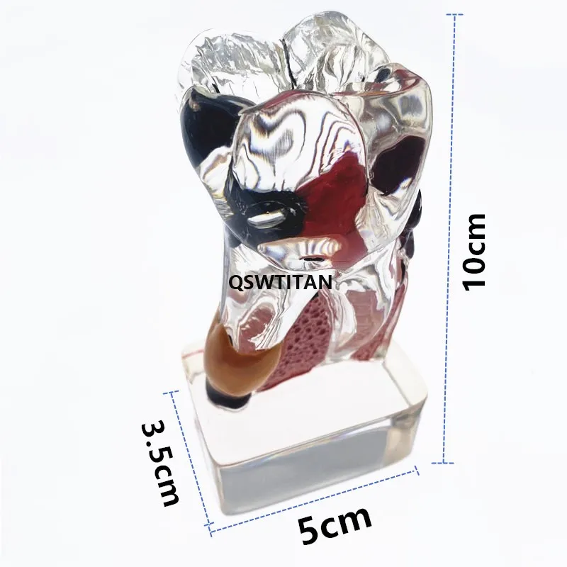 Dental Teeth Model 4 times tooth pathology model Comprehensive Periodontal Model For Teaching Study model