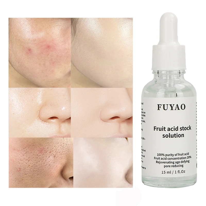 20% Glycolic Acid Oil Liquid Anti Wrinkles  For Face Cream Whitening Skin Care Anti-Aging Serum