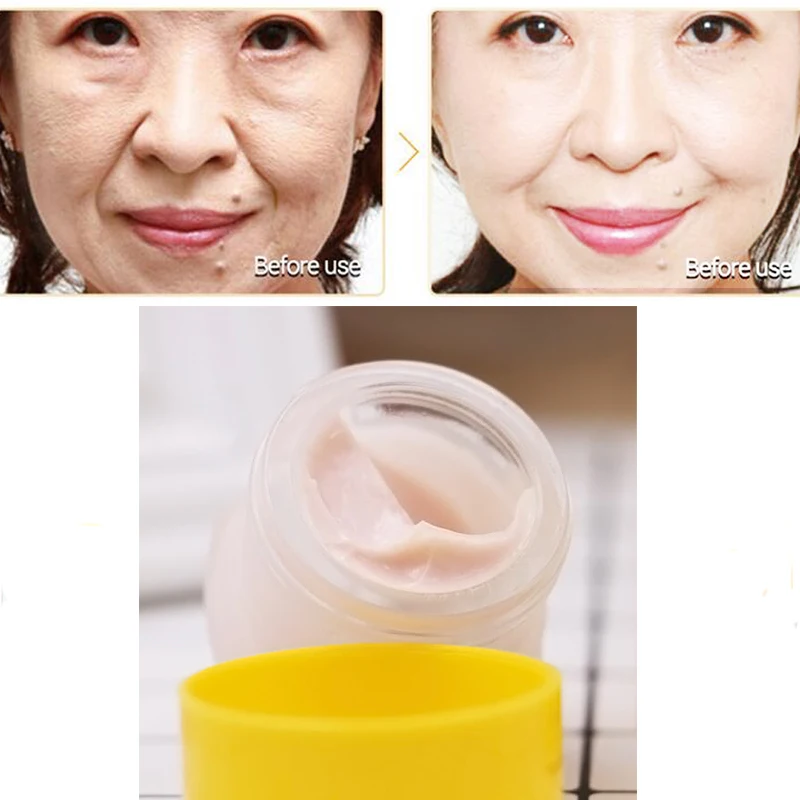 Whitening Remove Dark Spots Facial Cream  Skin Repair Fade Freckls Melanin Remover Chinese Medicine 20% Astragalus Brighten