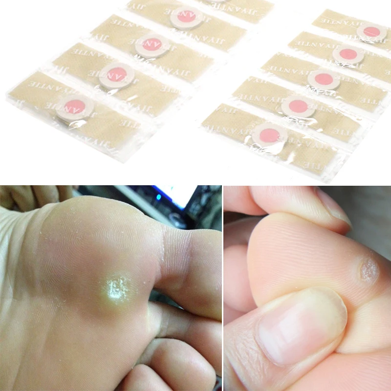 50Pcs Corn Plaster  Corn Adhesive Plaster  Medical Patch  Corn Calluses Removal Blister Canopy Patch Band-aids Foot Care Sticker