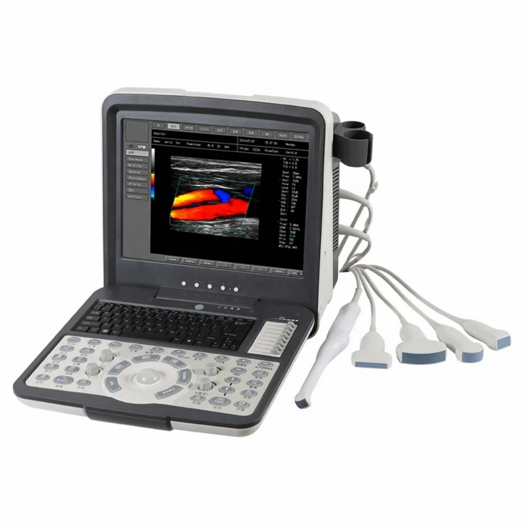 Diagnostic Ultrasound Equipment Hospital clinical Color Doppler Ultrasound for gynecological and obstetric ultrasound imaging