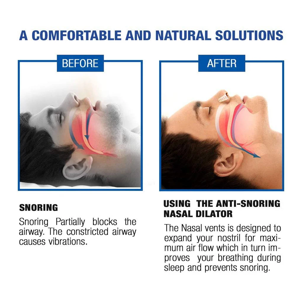 1/4/12 pz/set soluzione russare Anti russare dispositivi russare tappo naso prese d\'aria dilatatori nasali per un migliore sonno dormire aiuti