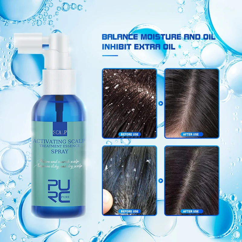 PURC Activating Scalp Treatment Hair Spray Anti Dandruff for Men Women Anti Itch Essence Oil Smoothing Hair Care 60Ml