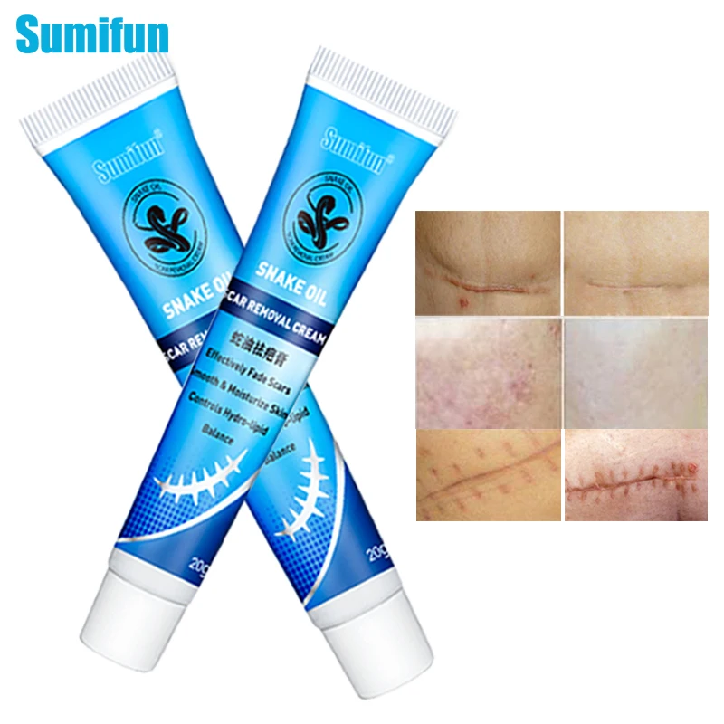 

Sumifun 1pcs Skin Repair Ointment Scars Cream Remove Old Scar Fade Acne Stretch Marks Healing Burns Cuts Skin Care Products 20g