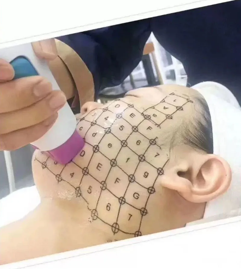 Papel de marcado facial, máquina de cuadrícula RF, venta al por mayor de fábrica