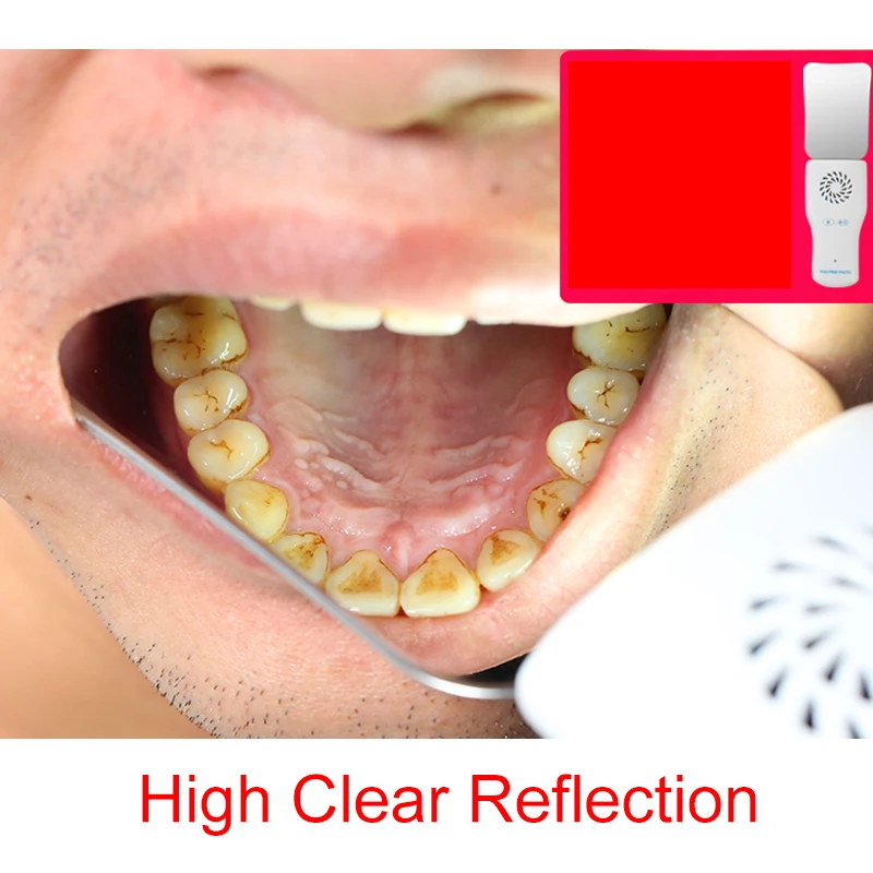 Dental Automatic Anti-fog Mirrors for Oral Photography Reflector Glass Defog Mirrors Orthodontic for Buccal Occlusal Lingual