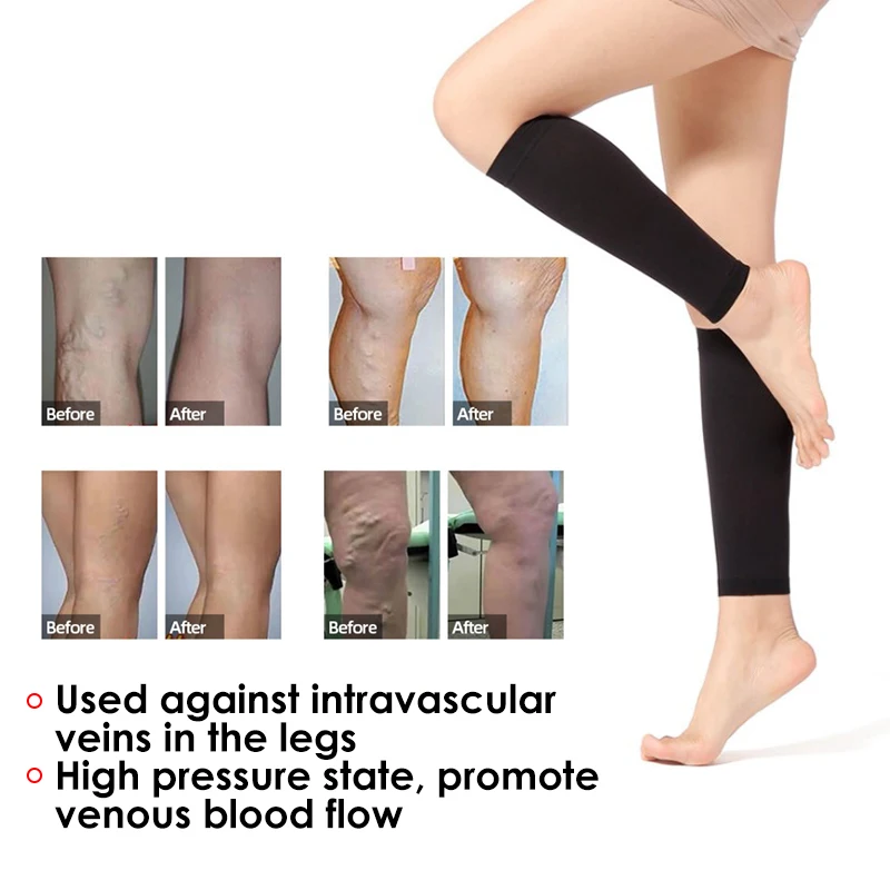 1Pair Varicose Veins Socks Treat Phlebitis Vasculitis Compression Stock Varicose Leg Pain Relief Breathable Elasticity Slim Sock