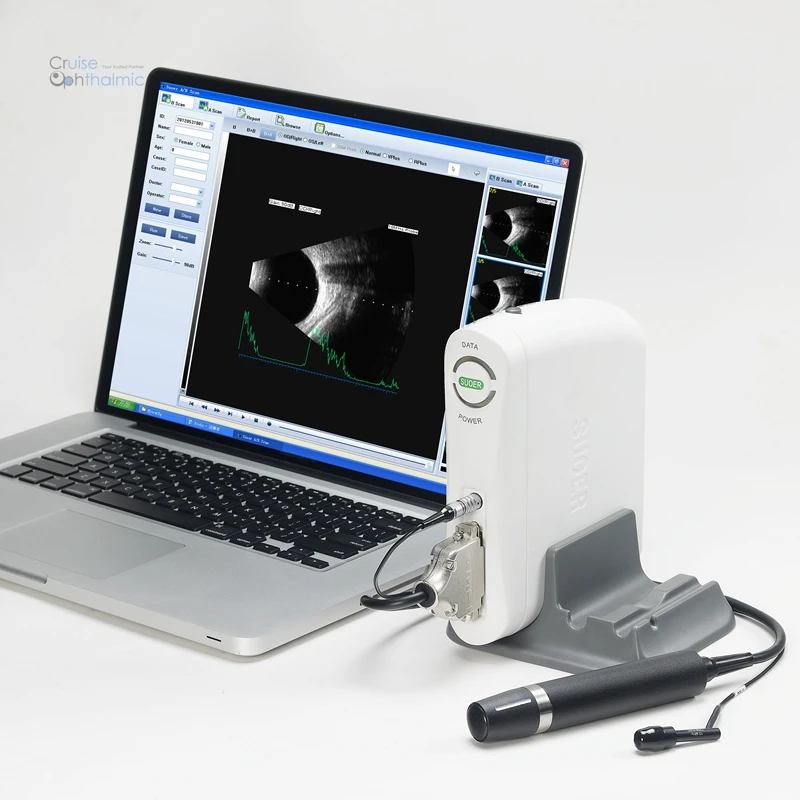 Ophthalmology A-B Scanner SW-2100 Portable Adapted to Laptop Ophthalmic Ultrasound Scan Machine a b scan with USB Connection