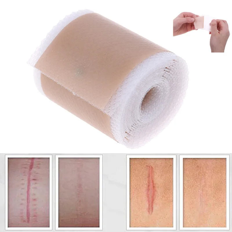 4x150cm/3.5x12cm Efficient Surgery Scar Removal Silicone Gel Sheet Therapy Patch for Acne Trauma Burn Scar Skin Repair Treatment