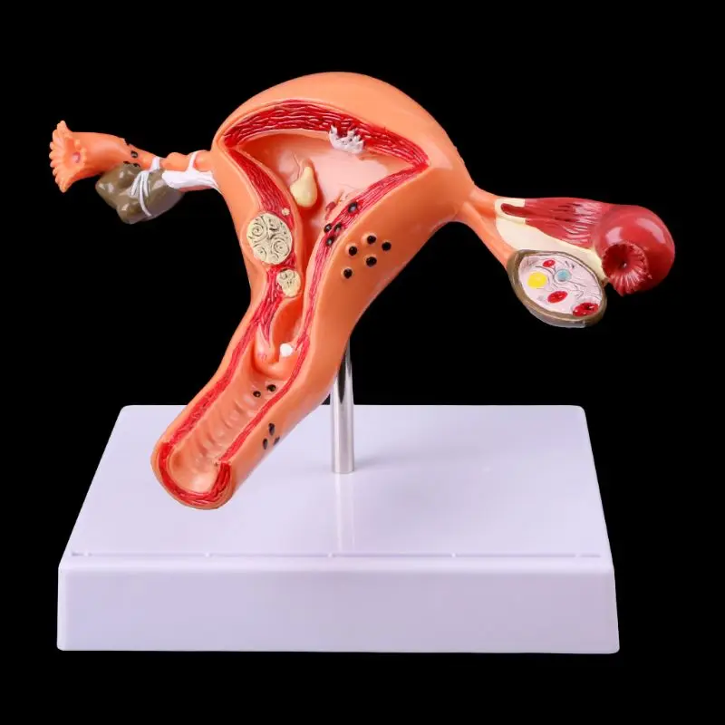 

Medical props model Free postage Pathological Uterus Ovary Anatomical Model Anatomy Cross Section Study Tool