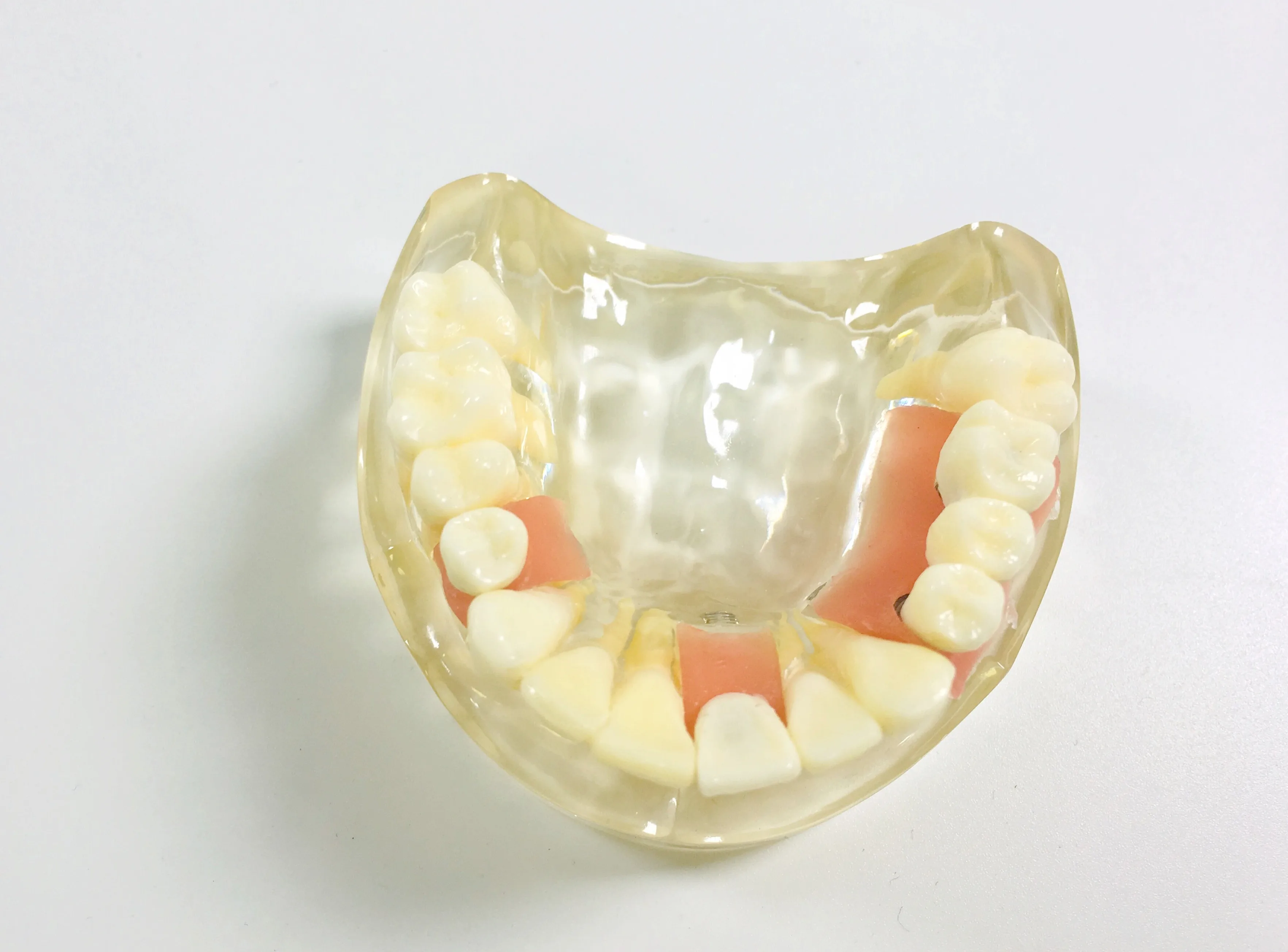 New Dental Model Teeth Implant Restoration Bridge Teaching Study Tooth Medical Science Disease Dentist Dentistry Products