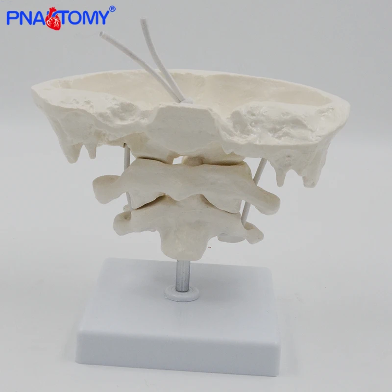 Enlarged Detachable Human Cervical Vertebra Atlas and Axis Bone Spine Anatomical Model Medical Equipment Teaching Tool Skeleton