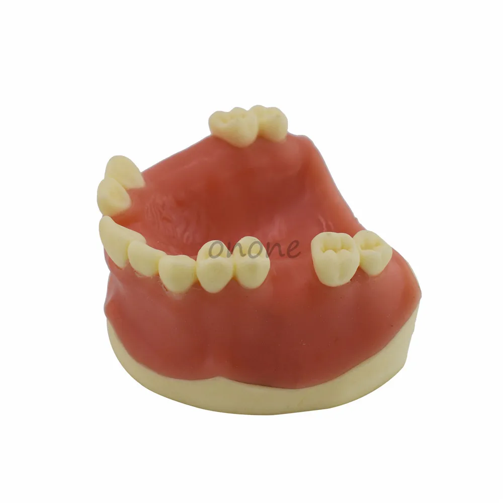 1pcs Maxillary Missing Tooth Model Bone Imitating Oral Teaching Aids Dental Implant Placement Exercise Prop