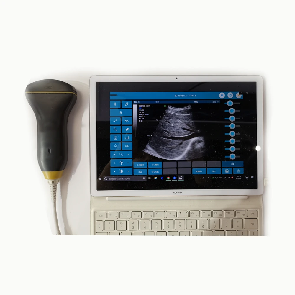 Mini Type C USB Color Doppler USG Linear And Convex Probe Ultrasound Scanner Machine