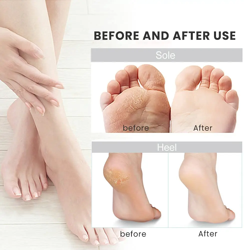 ชาร์จไฟล์เท้าไฟฟ้าแคลลัส Remover เครื่องอุปกรณ์ Pedicure Foot Care เครื่องมือสำหรับรองเท้าส้นสูงลบ Dead Skin สีดำ