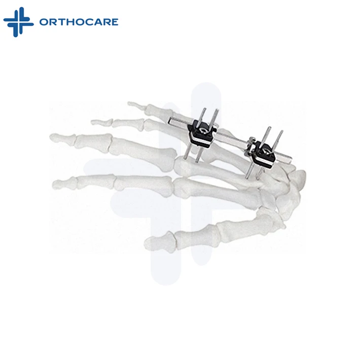 Ortho fix System Mini External Fixation Frame Orthopedic Instruments