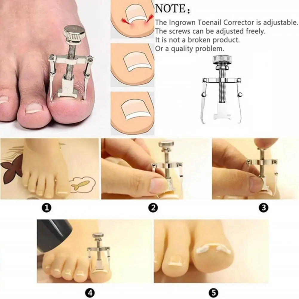 1 Set strumento per unghie incarnite posizione precisa strumenti per Pedicure professionali Ingrown unghia sollevatore lima per unghie Kit per Manicure per piedi