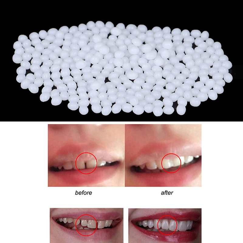 Temporary Tooth Repair Kit Teeth And Gaps FalseTeeth Solid Glue Denture Adhesive Teeth Whitening Tooth Beauty Tool 5/10/15/20g