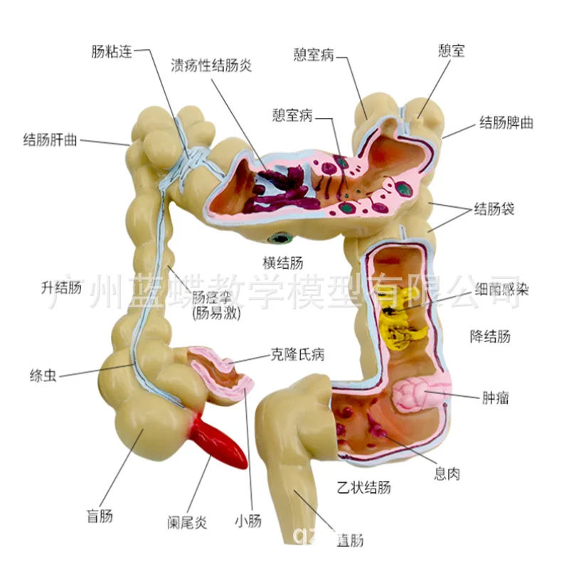 1/2 Life Size Human Rectal Pathology Colon Model Large Intestine Model Anorectal Anatomical Model Tools