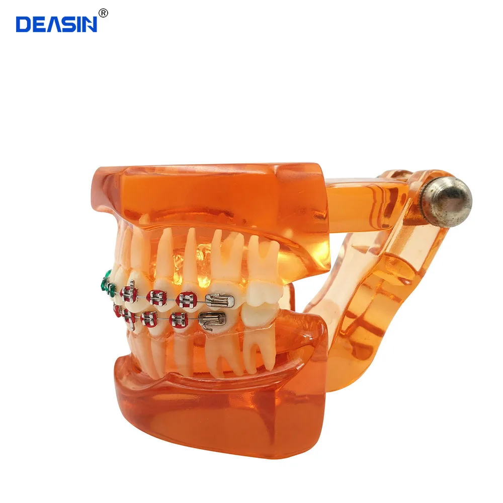 Dental Orthodontic Teeth Model with metal and ceramic bracket/Dental Orthodontic traning teeth model