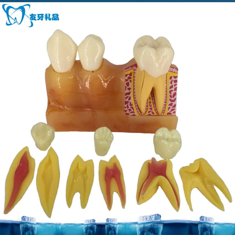 4 Times Tooth Decomposition Resin Model Dental Pulp and Anatomical Oral Cavity Model Teaching Explanation