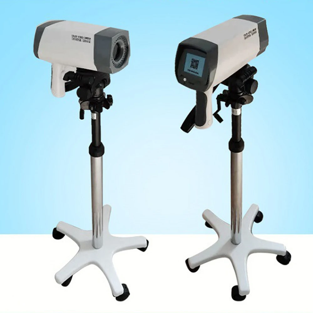 High-definition color Supplier Colposcope Gynecology Examination Digital With screen imagingColposcopio for Clinic