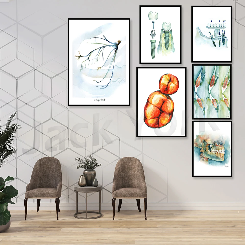 Dental Implant Watercolor Art Print - Dental Anatomy Art - Dental and OMFS Anatomy