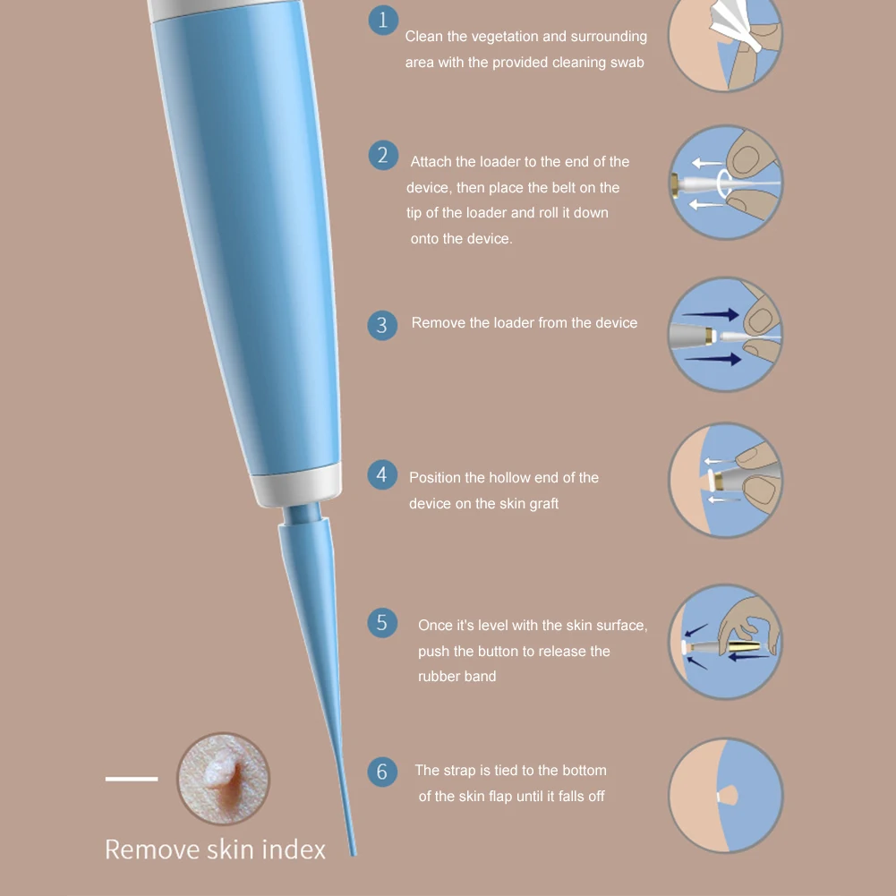 Herramienta de eliminación de papiloma para el cuidado de la cara, Kit de microbanda azul, removedor de etiquetas de piel, maíz con hisopos de limpieza, verruga de Topo