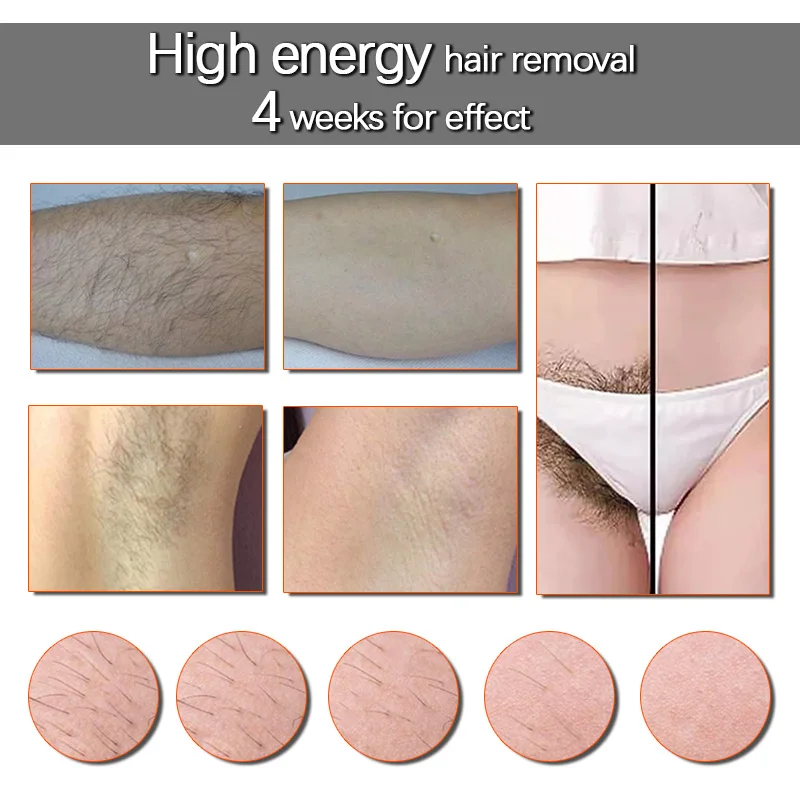 Laser Hair Removal Epilator Sapphire Permanent Depilator Machine Full Body Hair Removal Device Painless Personal Care Appliance