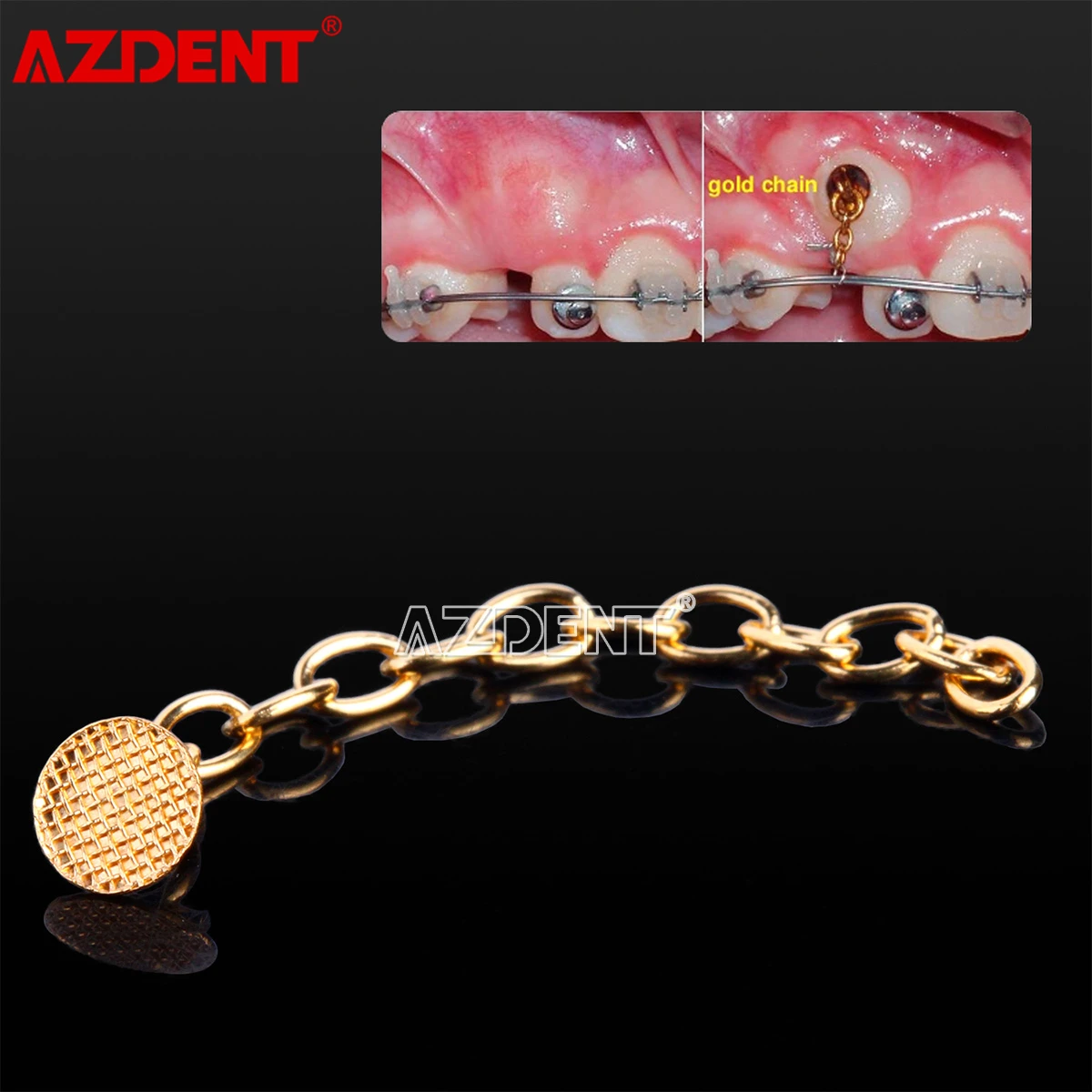 2 Teile/paket AZDENT Dental Kieferorthopädische Traktion Taste Kette Runde Basis Goldene Silber – Detail 9