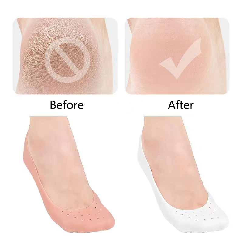 2Pcs=1 pair Silicone Feet Care Boat socks Moisturizing Gel Heel Socks with Hole Cracked Foot Skin Care Protectors Foot Care Tool