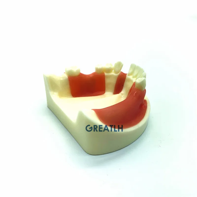 Dental Implant Practice model Lower Jaw model with missing teeth for cutting and suturing Typodont Teeth Model with Gingiva