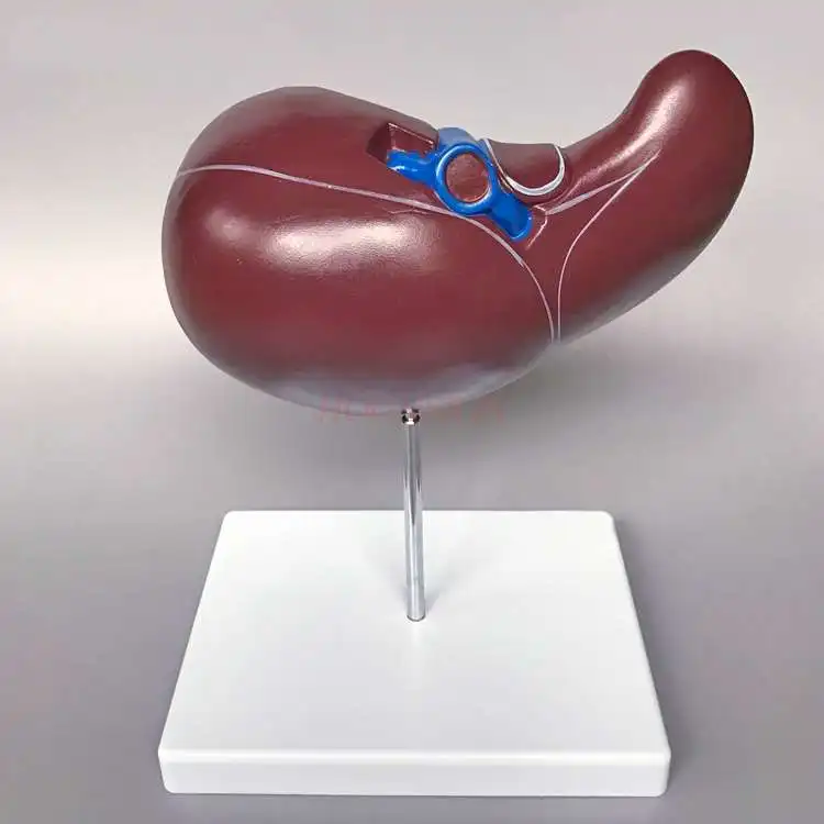 

Hepatobiliary model Liver anatomy model Human liver blood vessels Hepatobiliary structure gallbladder bile duct display teaching