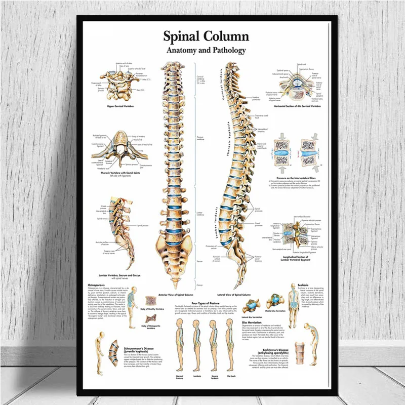 Poster And Prints Anatomy Human Body Medical Spinal Column Knee Joint Foot Painting Art Wall Pictures For Living Room Home Decor