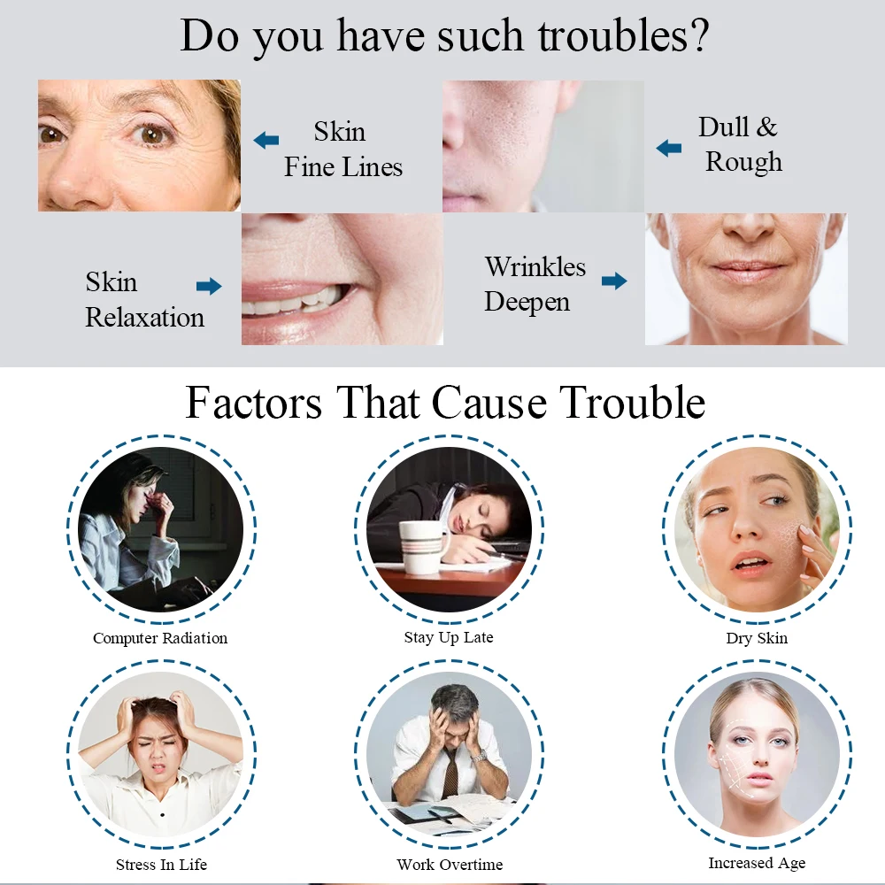 ENVISHA Neck Creme Retinol Gesicht Vitamin Kollagen Bleaching Anti-Falten Anti-aging-feuchtigkeitscreme Hautpflege Hyaluronsäure Schrumpfen Poren – Detail 6