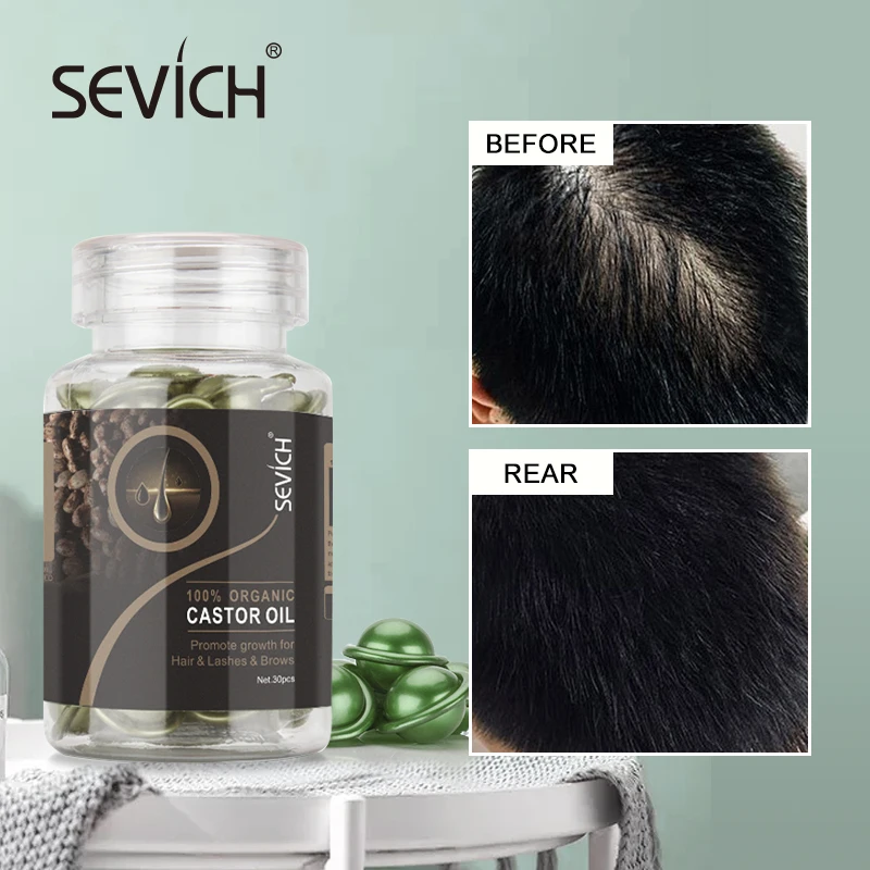 Sevich 2PCS/Set Ginger Hair Growth Capsules Set Hair Vitamin Oil For Hair Loss Repair Treatment Damaged Hair Black Hair Serum