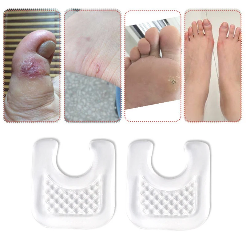 Cuscino per piedi in Silicone Anti sfregamento callo adesivo per mais protezione per i piedi cuscini riutilizzabili Pad scarpe solette adesivo punta