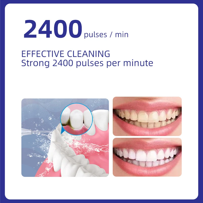 1000ml Oral Irrigator Water Flosser Dental Floss Teeth Whitening Mouthwasher Cleaning Irrigation Tooth Care Large Capacity