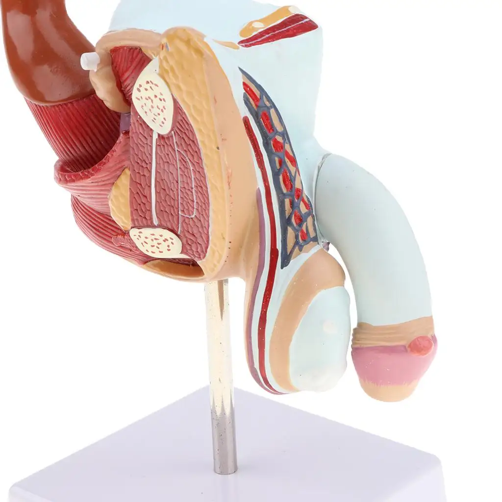 의료 남성 재생산 질병 해부학 인간 남근 재생산 기관, 해부학 모델, 비뇨기 시스템, 병리 모델