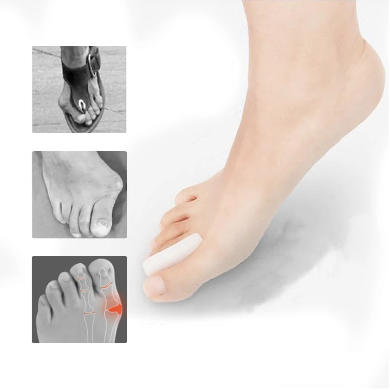 2Pcs Hallux valgus Silicone Gel Toe Bunion Corns Blisters Foot Care Pain Relief Toes Thumb Protect Orthotics Foot Massage Z28901