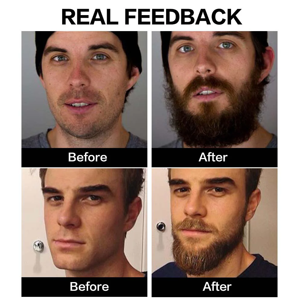 Pure Beard Growth Oil Men Anti Hair Loss Grow Mustache Essence Oil Thicker Fuller Men's Natural Ingredients Beard Oil 60ml