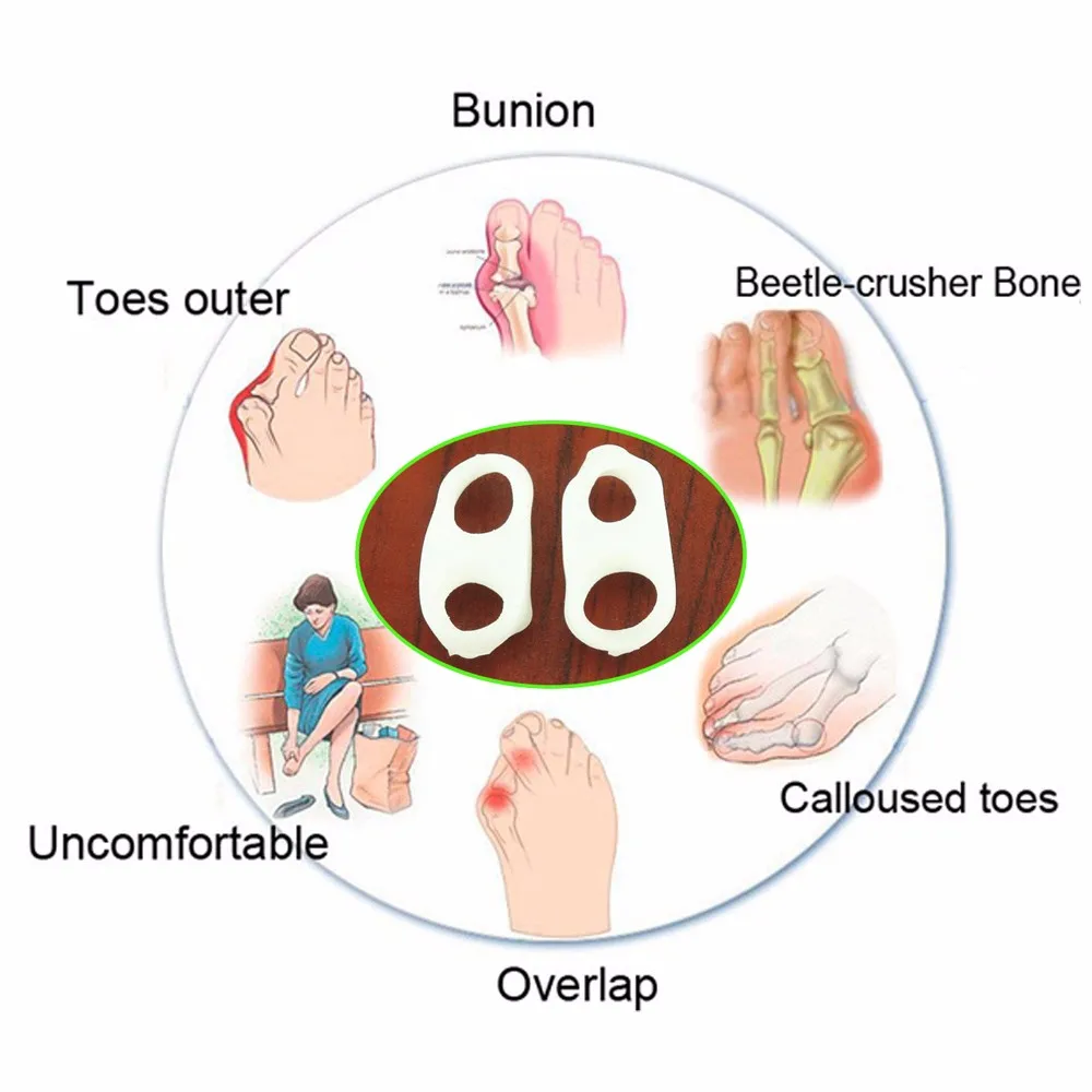 Sumifun 2 stücke Toe Separator Silikon Weichen Fuß Treuer Lindern Überlappenden Schmerzen Hallux Valgus Korrektur Richt Werkzeuge