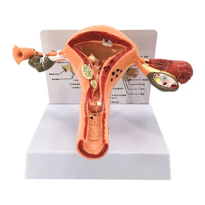 

Female reproductive uterus model, vaginal ovary model, healthy teaching mould pathological change scientific teaching AIDS