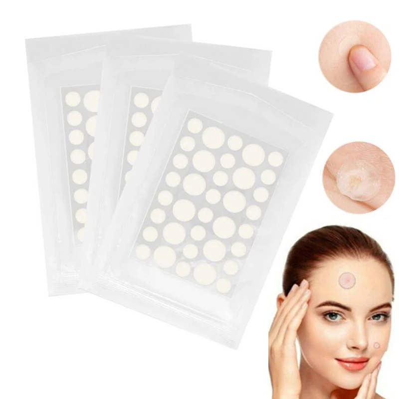 Acne Pimple Patch Stickers Acne Pimple Remover Tool Absorb Pus And Oil Acne Patch Face Skin Care As Protective Cover 36 Patches