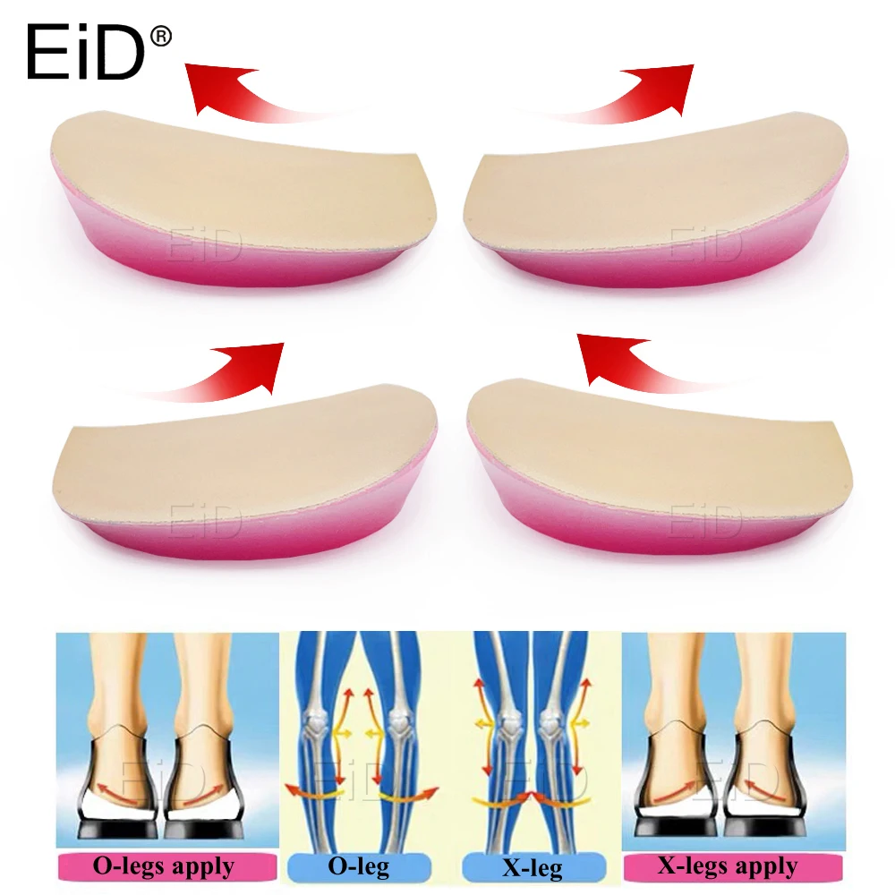 EiD XO Legs Silicone Gel Orthopedic Insoles for Arch Support Pad  Flat Foot Orthotic Inserts Pain Relief High Heel Pads Unisex